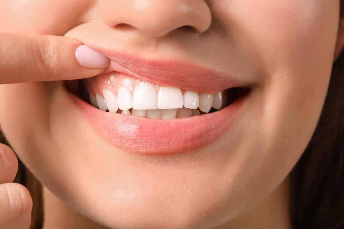 Recognising and treating inflamed gums: Your guide